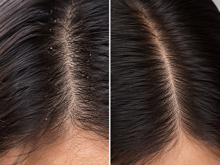 Scalp problems